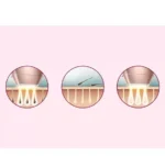 ЕПИЛАТОР PHILIPS LUMEA SC1994 - Image 7